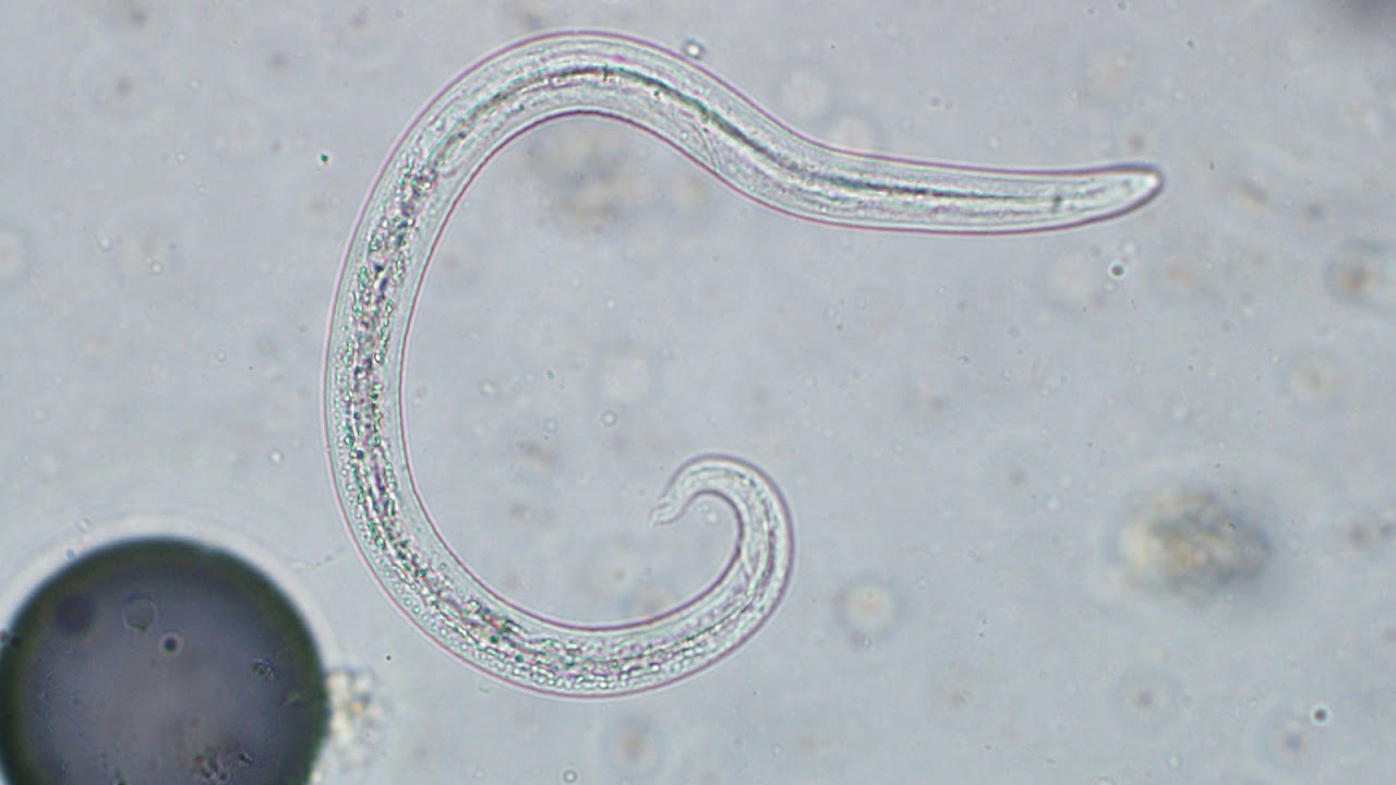Kedilerde Aelurostrongylosis
