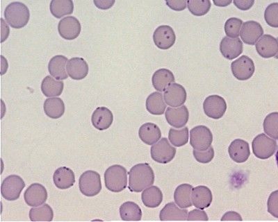 Kedilerde Haemobartonellosis